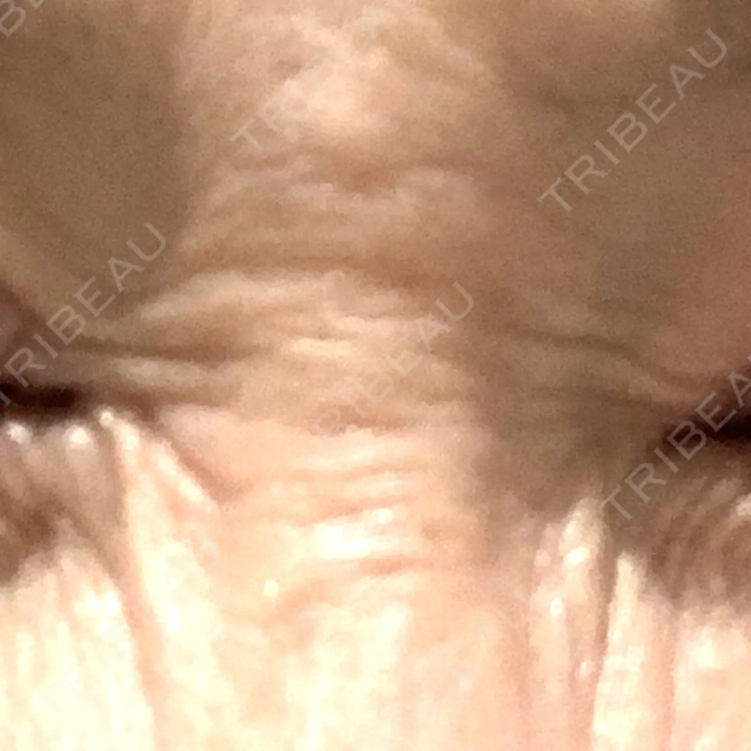 施術後の写真