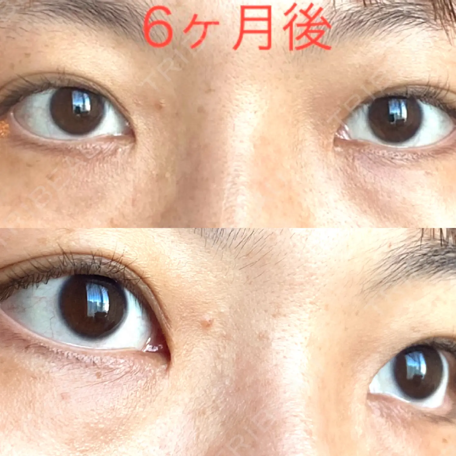 施術後の写真
