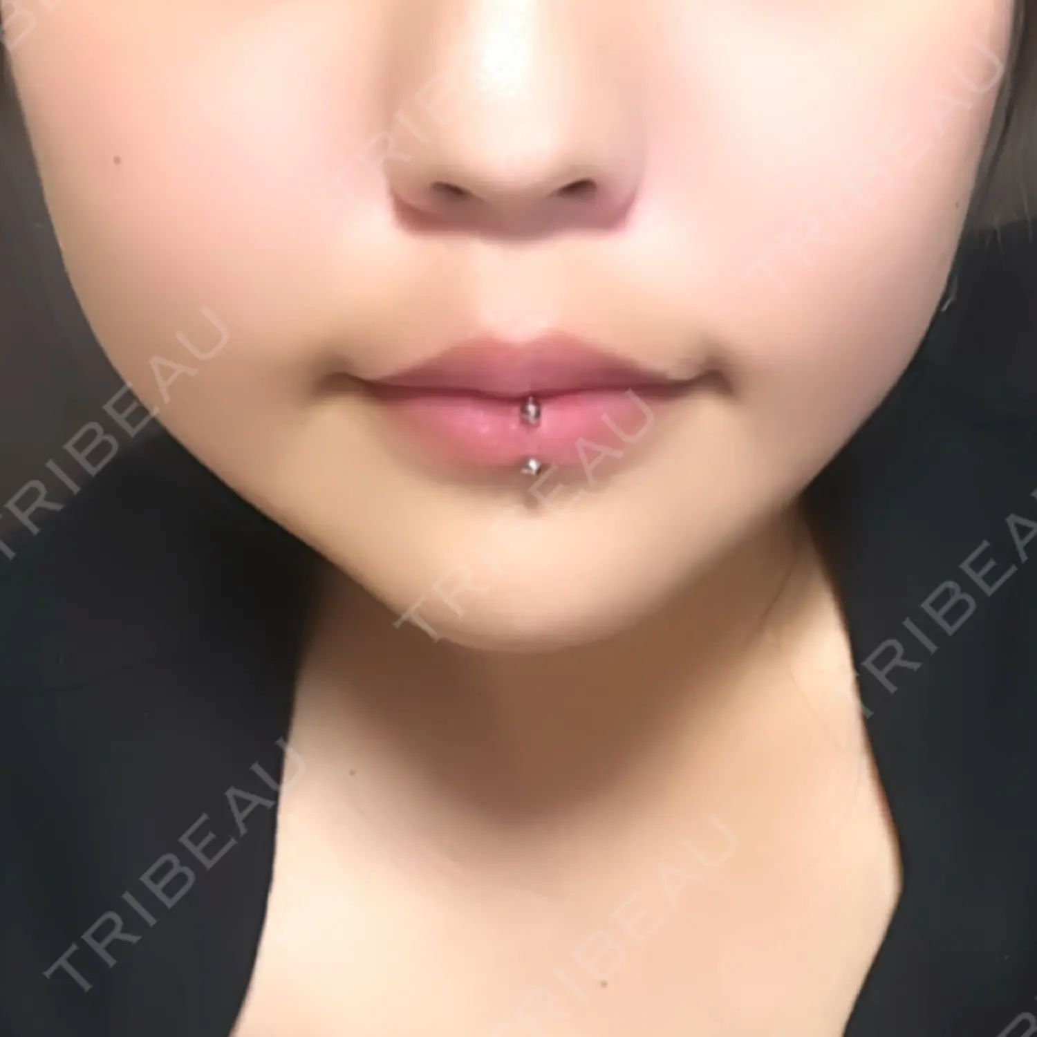 施術後の写真