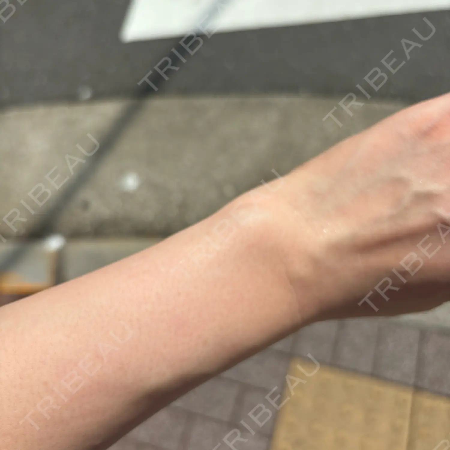 施術後の写真