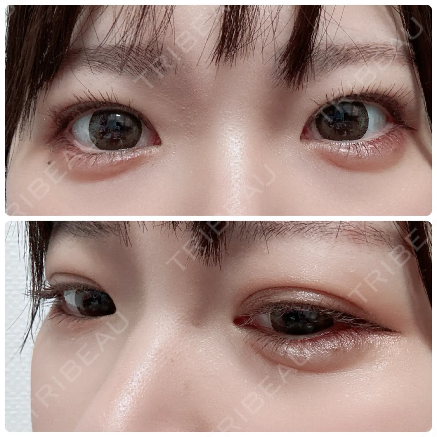 施術後の写真