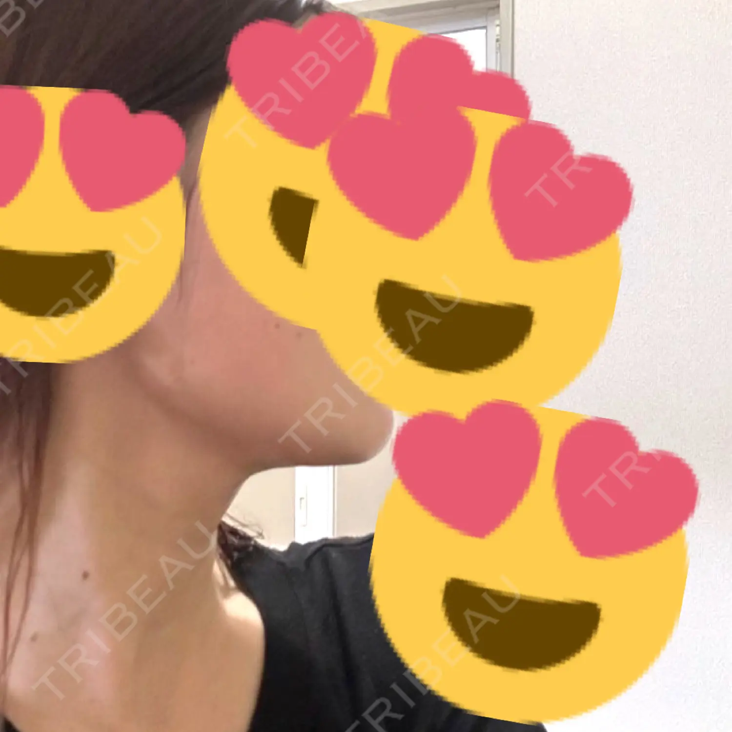 施術後の写真