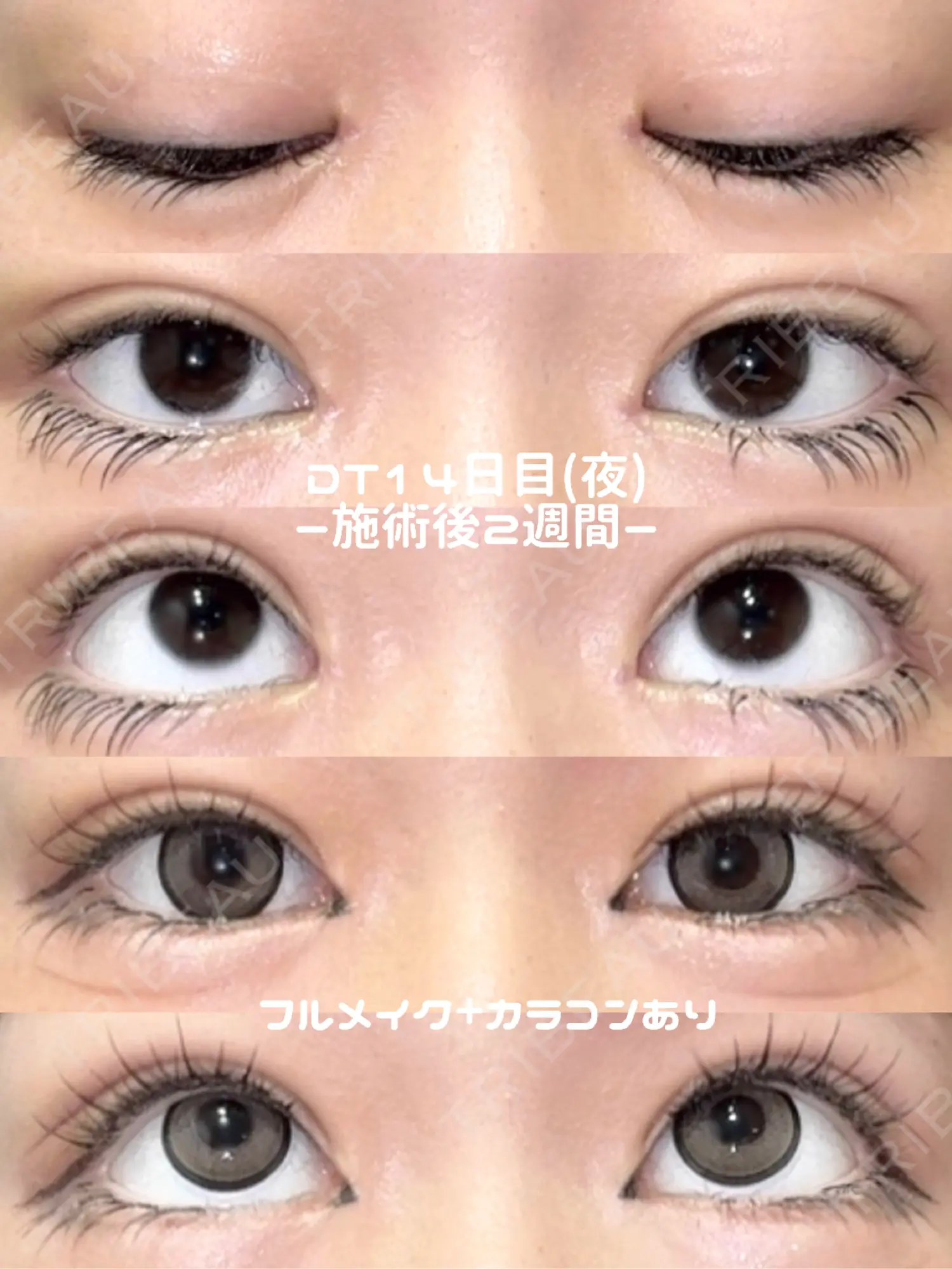 施術後の写真
