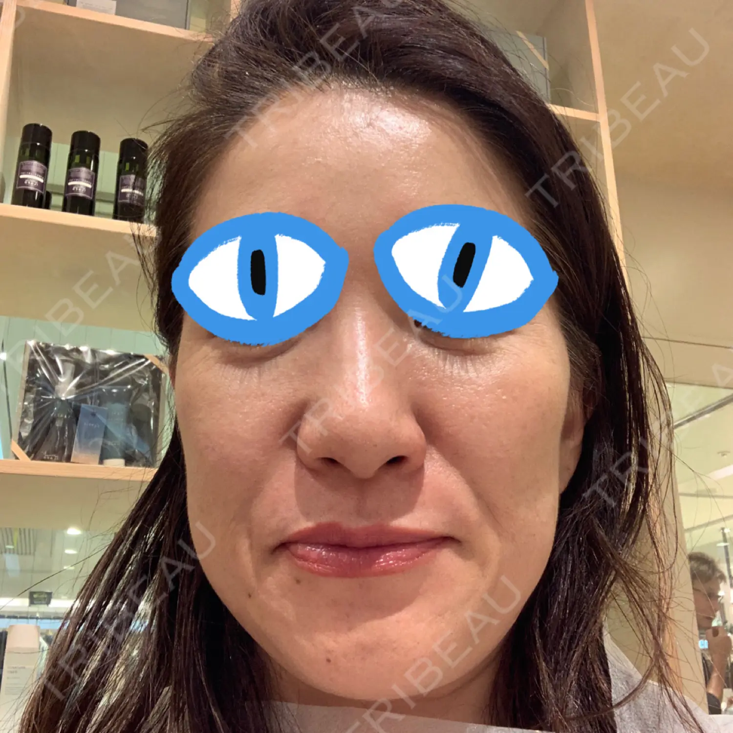 施術後の写真