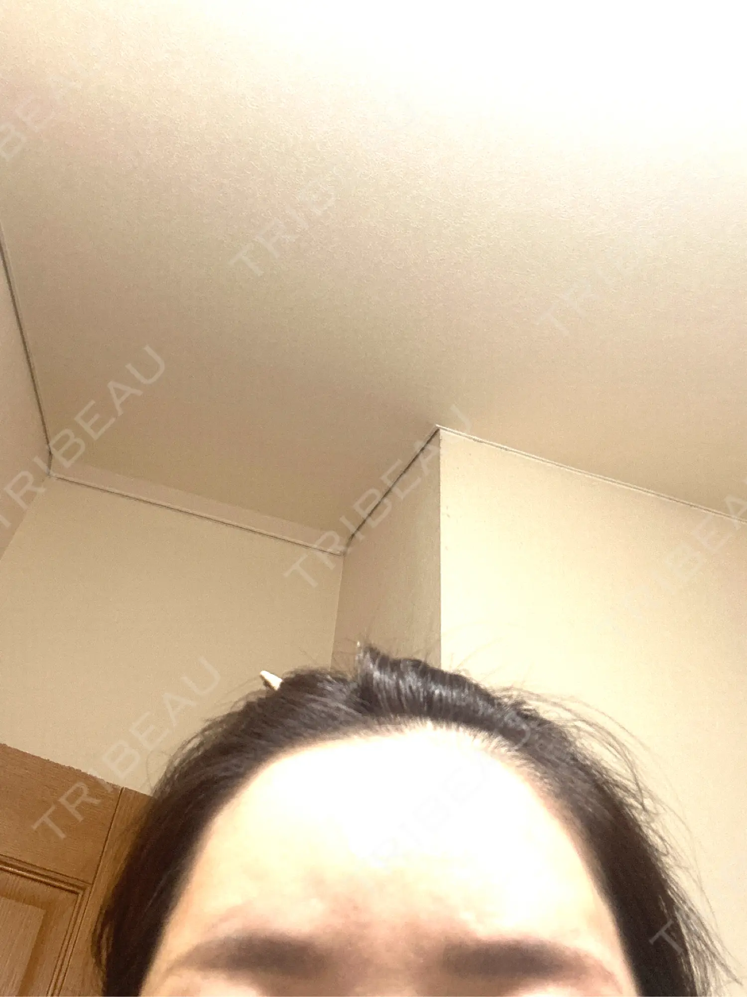 施術後の写真