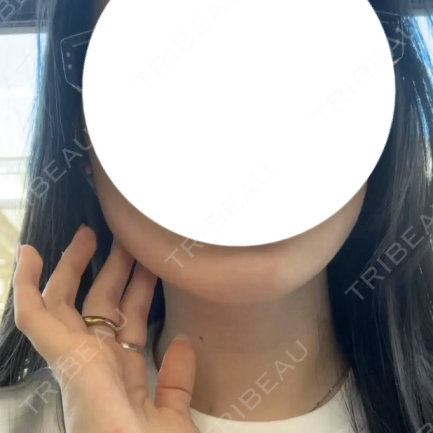 施術後の写真