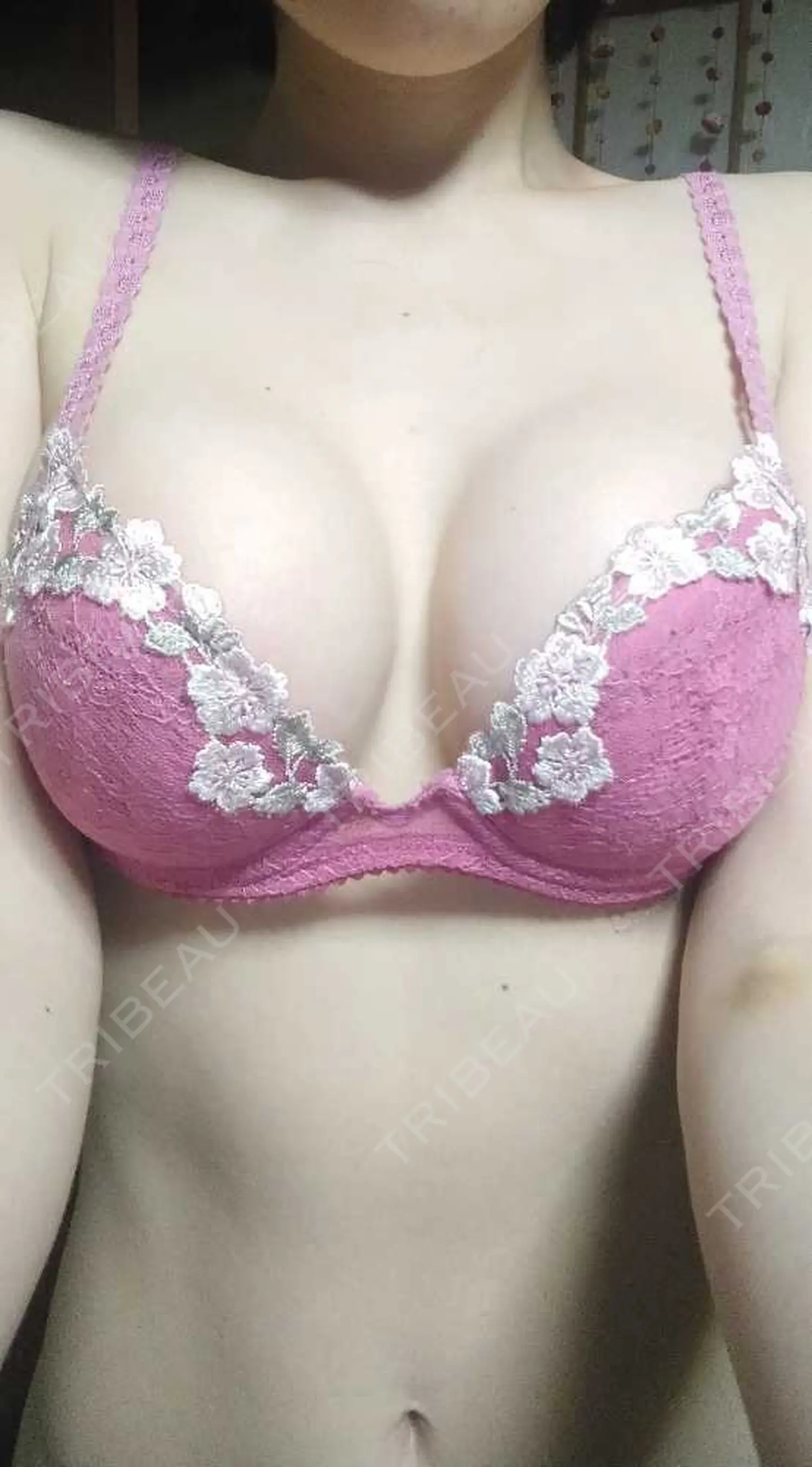 施術後の写真