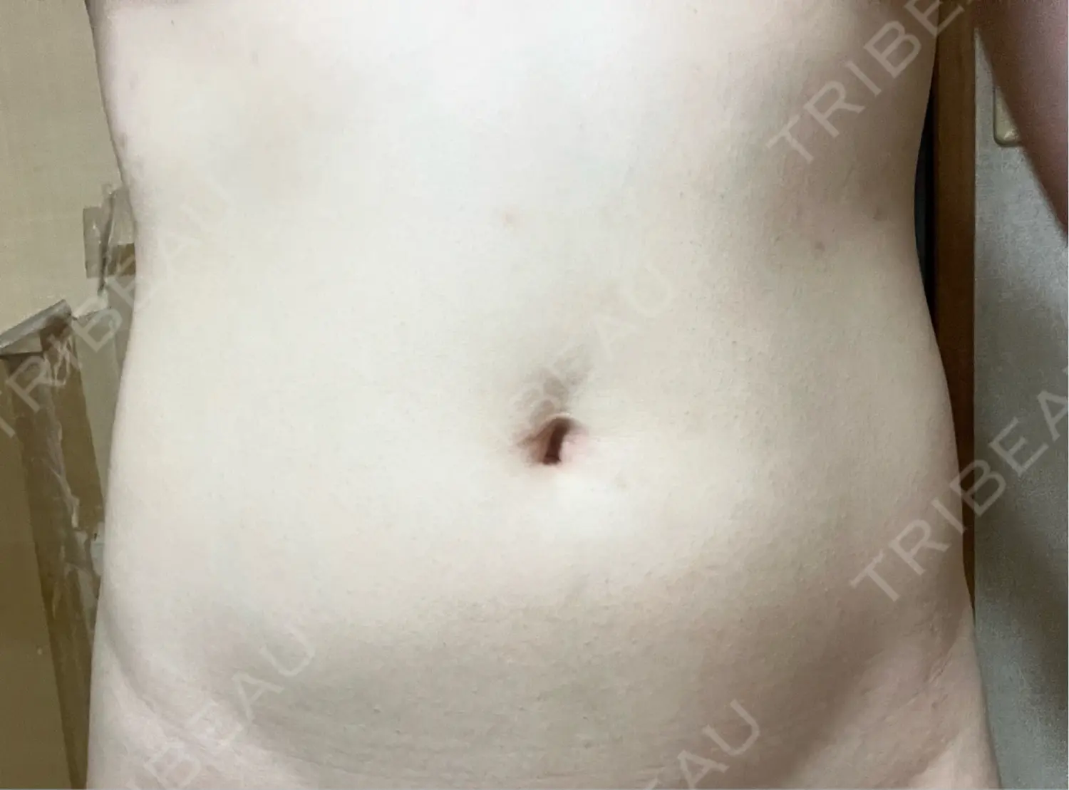 施術後の写真