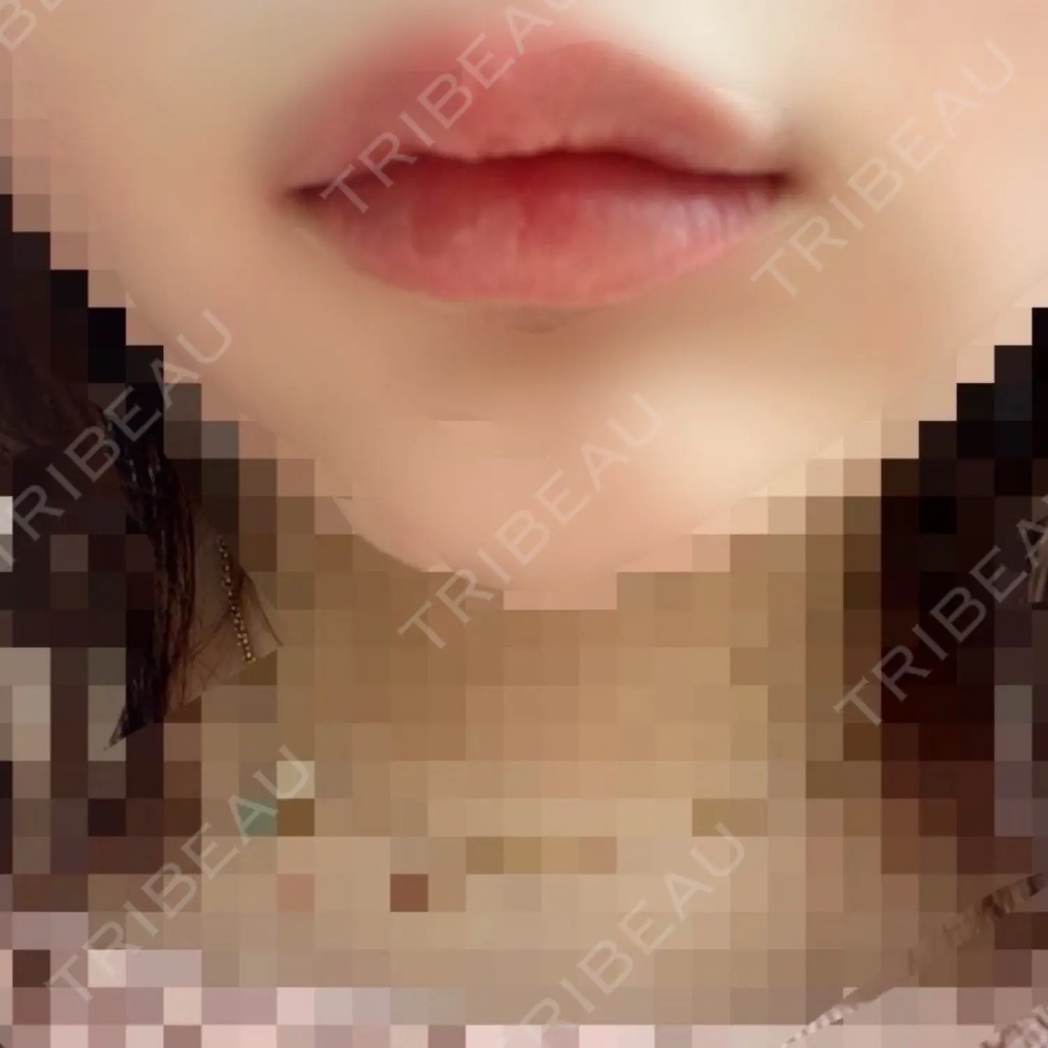 施術後の写真