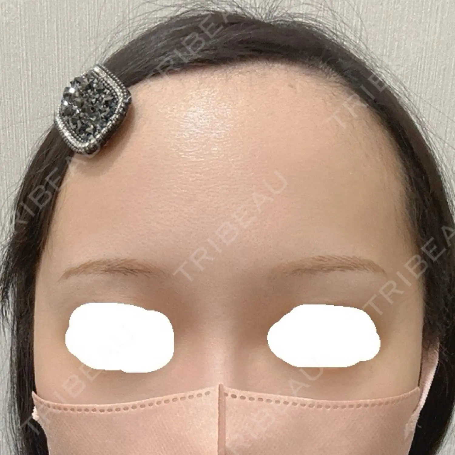 施術後の写真