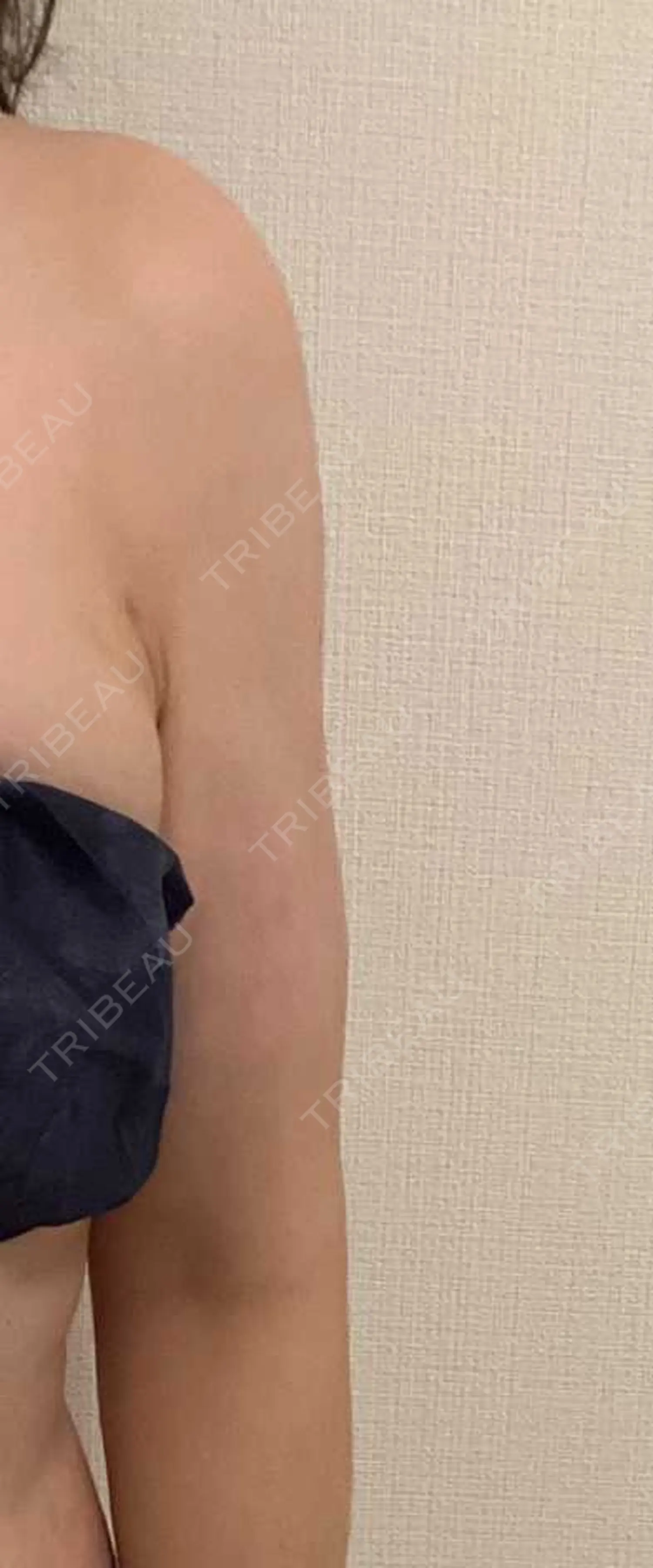 施術後の写真