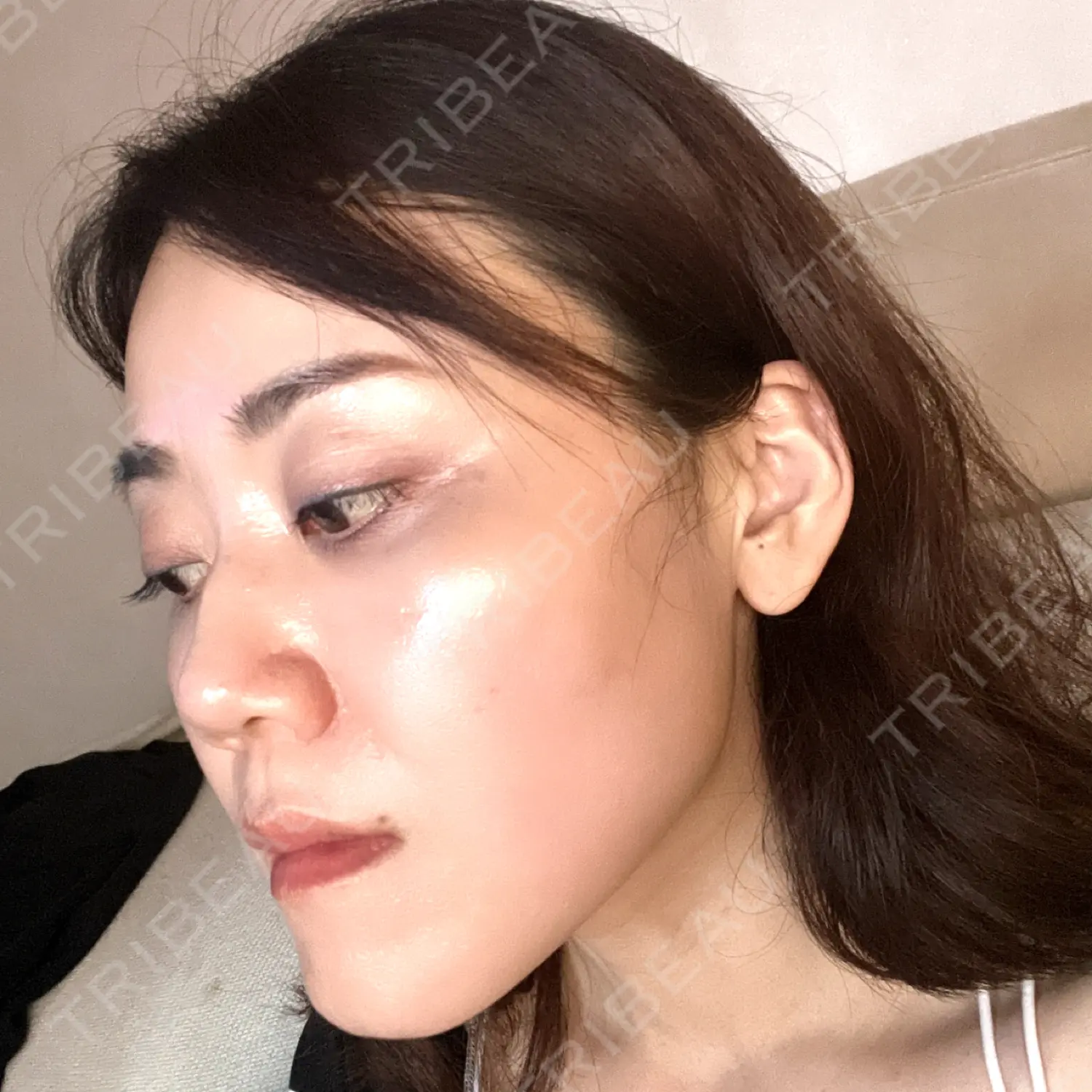 施術後の写真