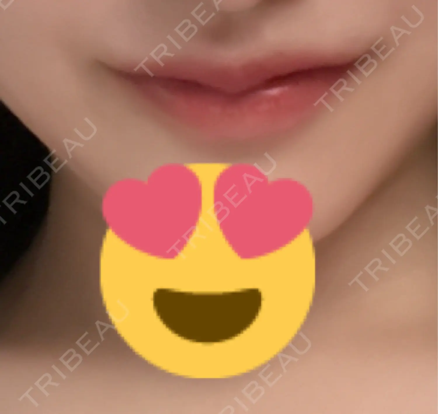 施術後の写真