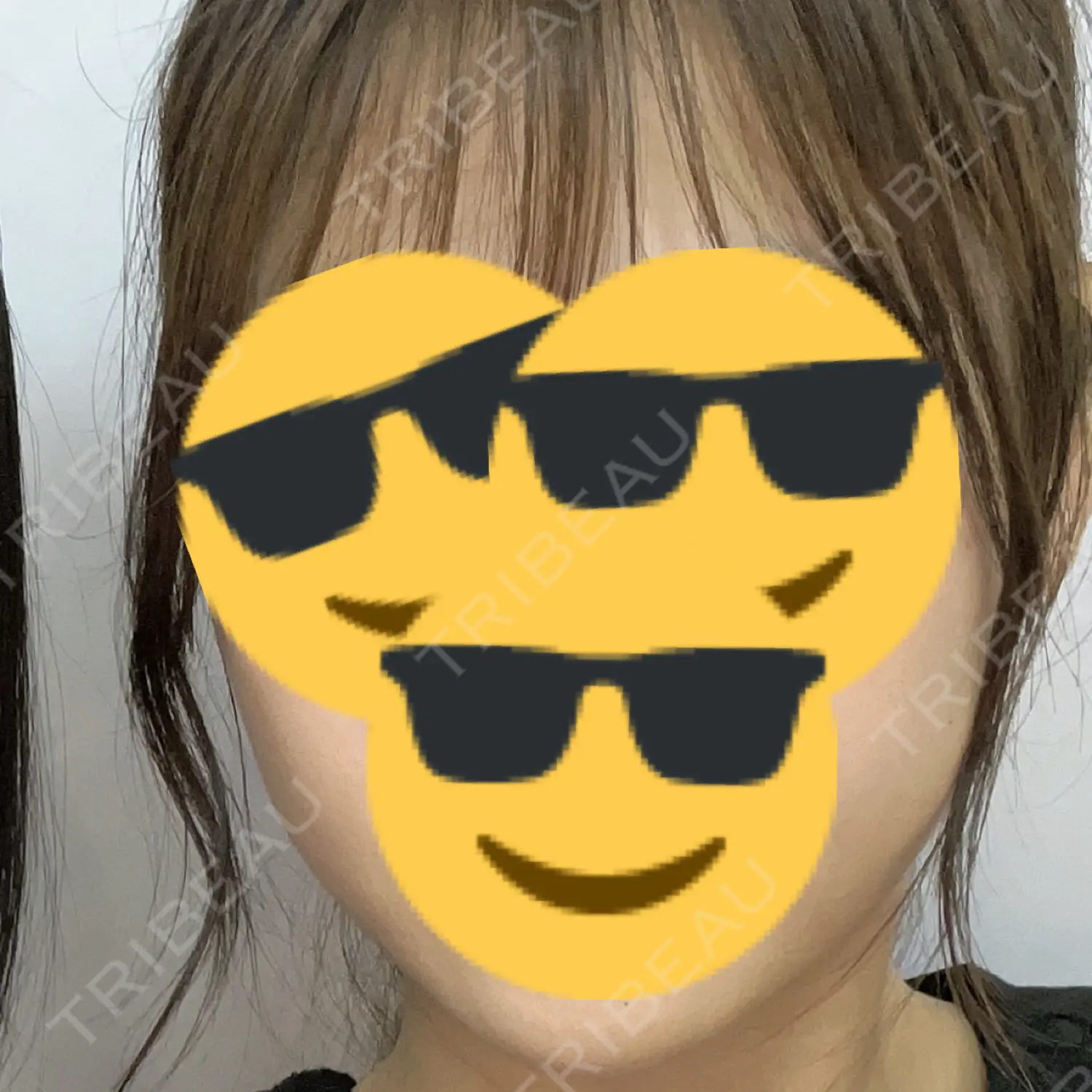 施術後の写真