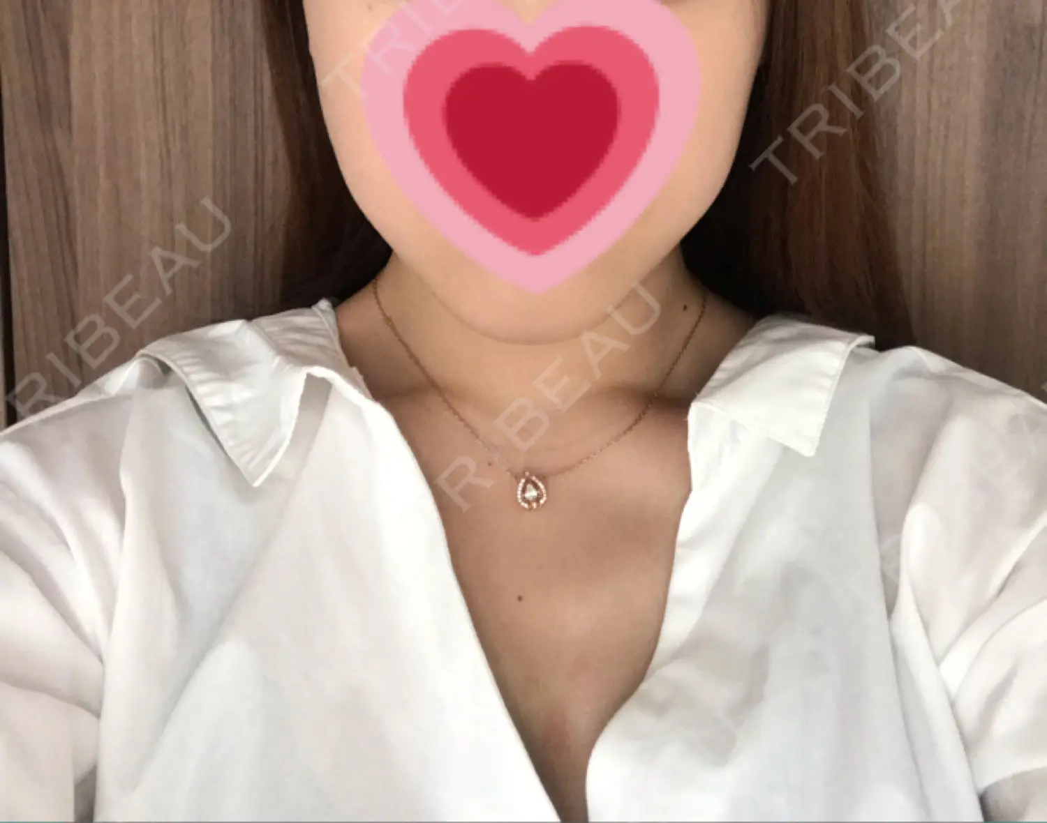 施術後の写真