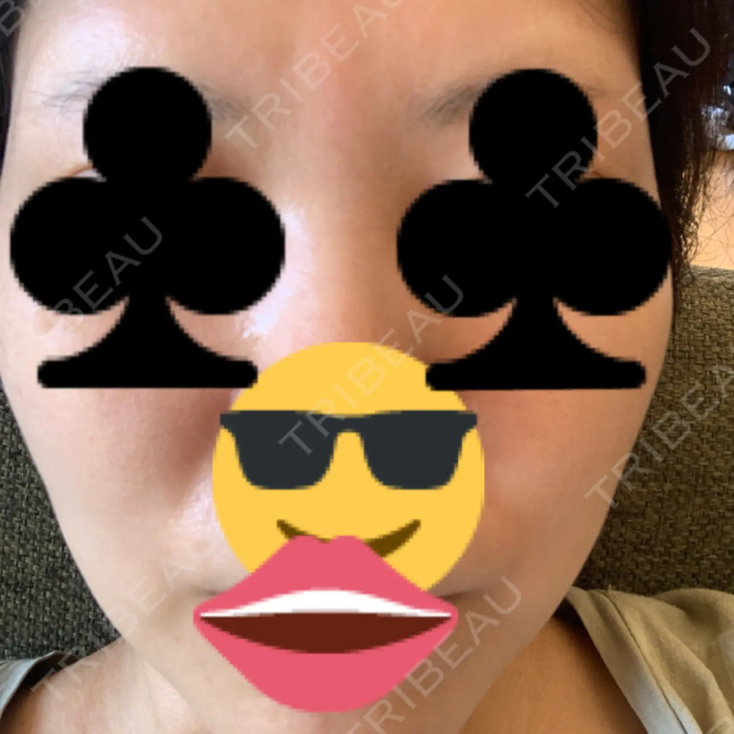 施術後の写真