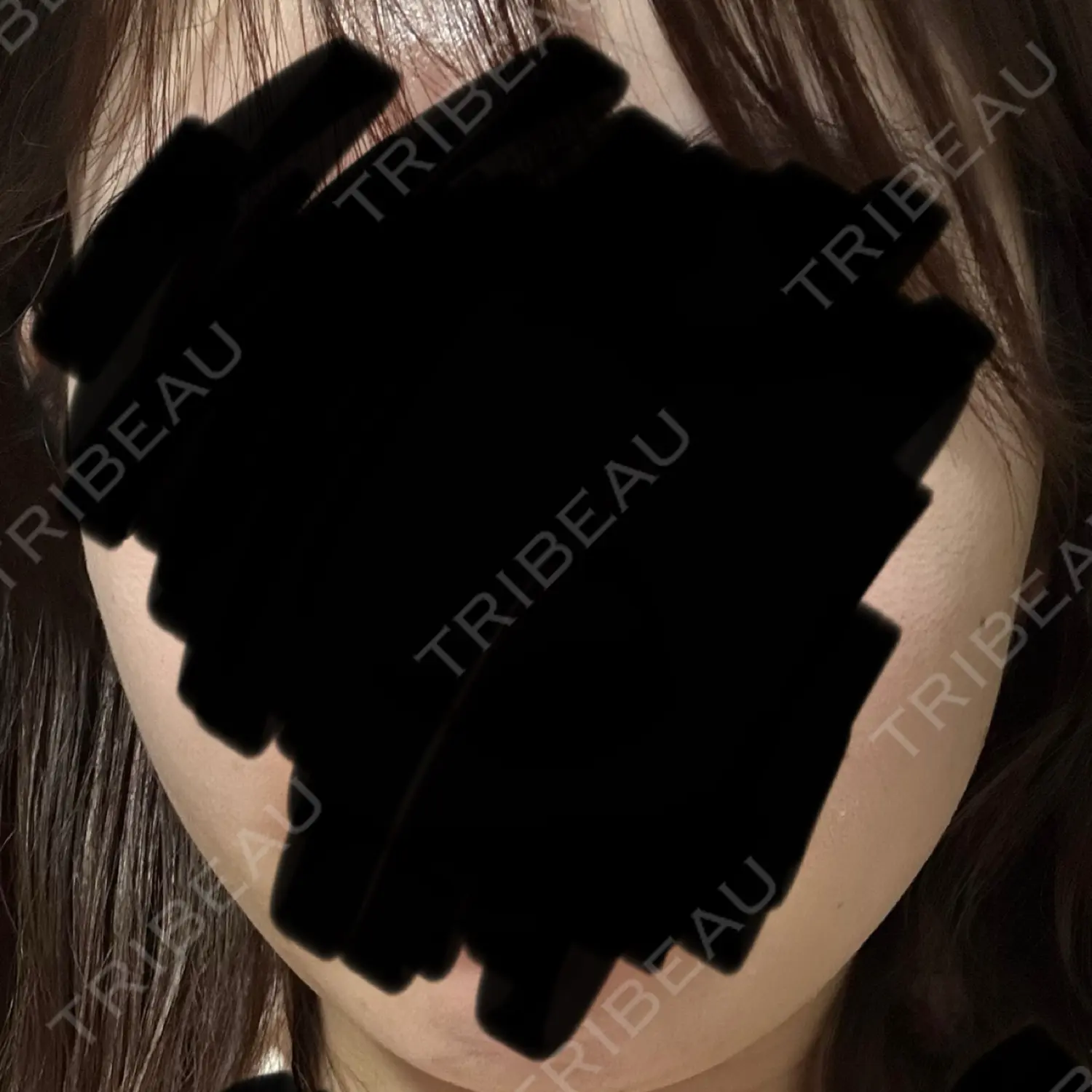 施術後の写真
