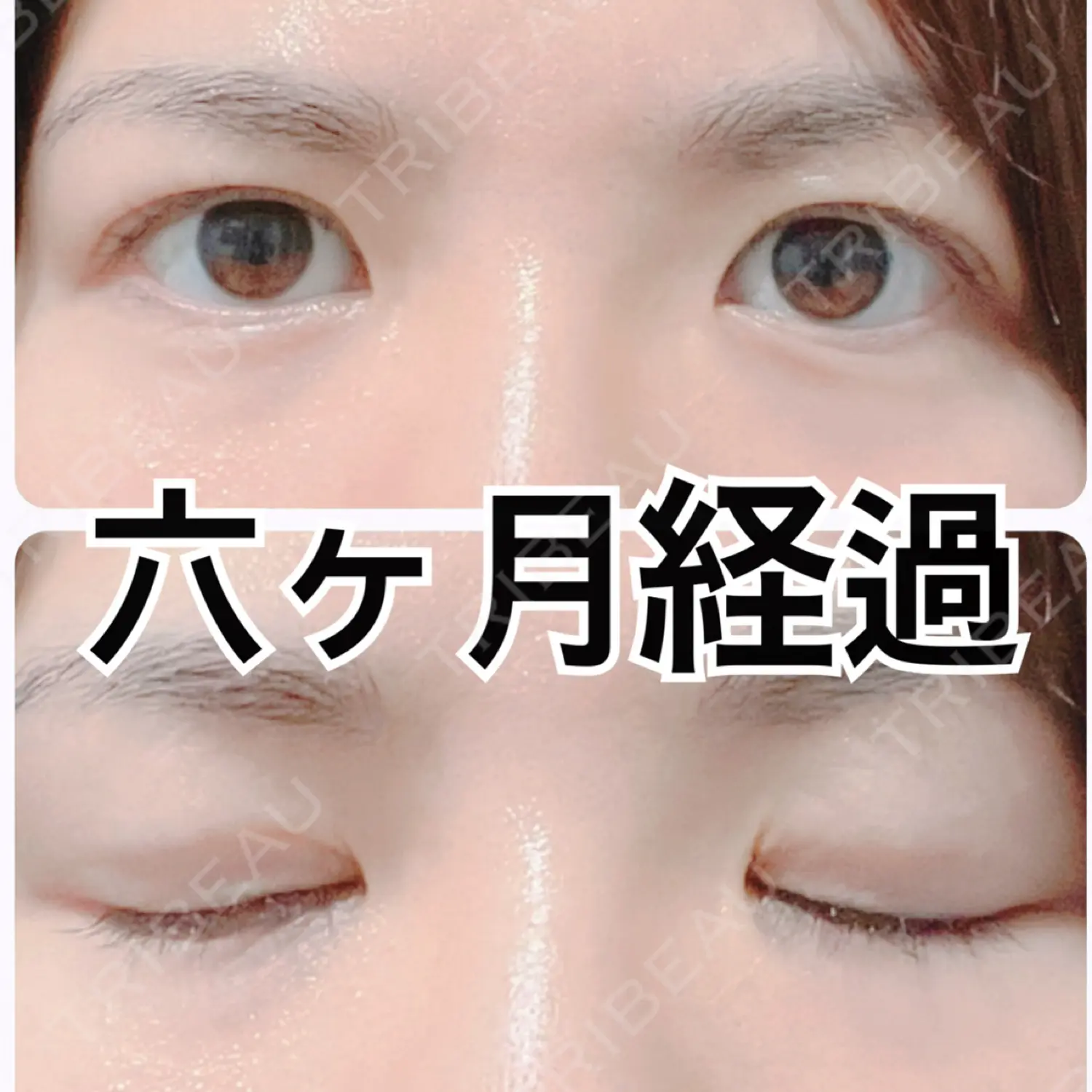 施術後の写真