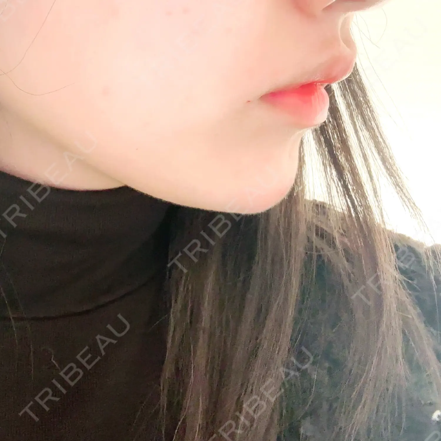 施術後の写真