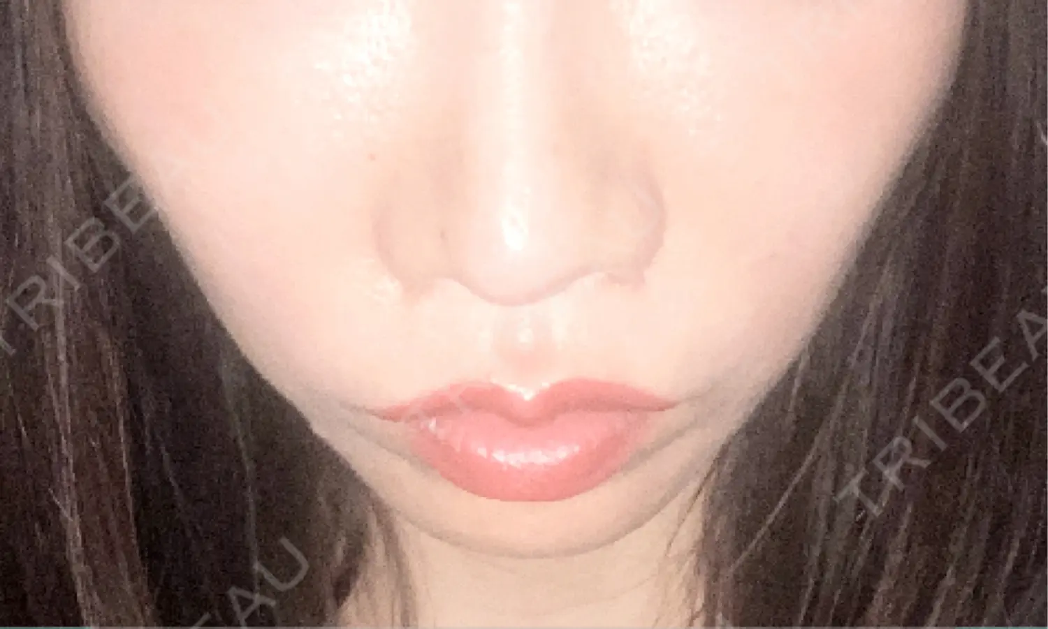施術後の写真