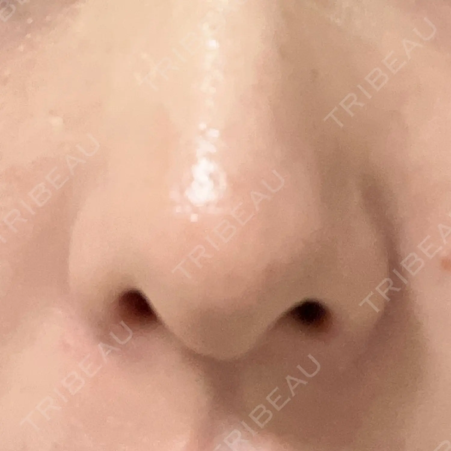 施術後の写真