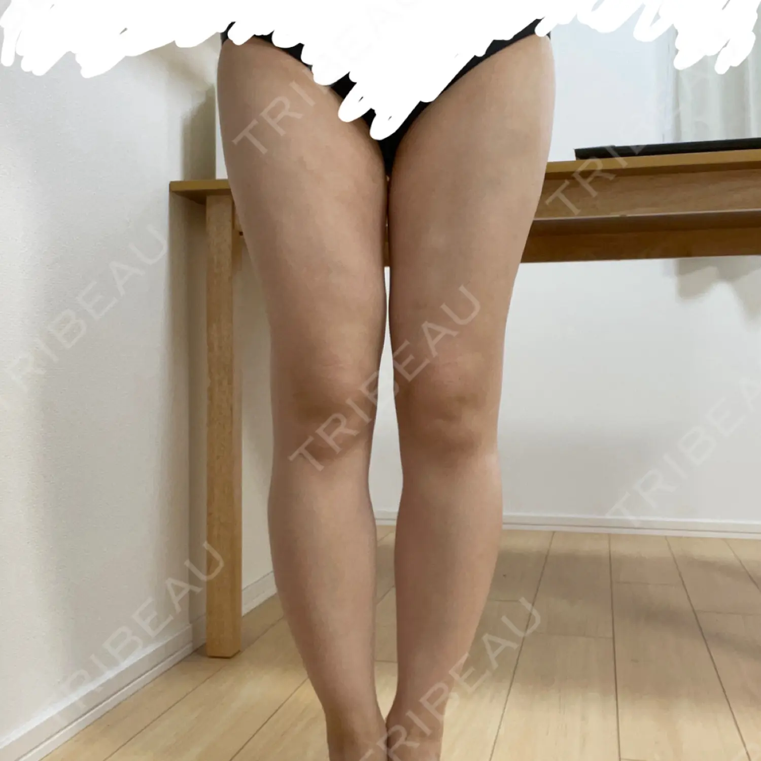 施術後の写真