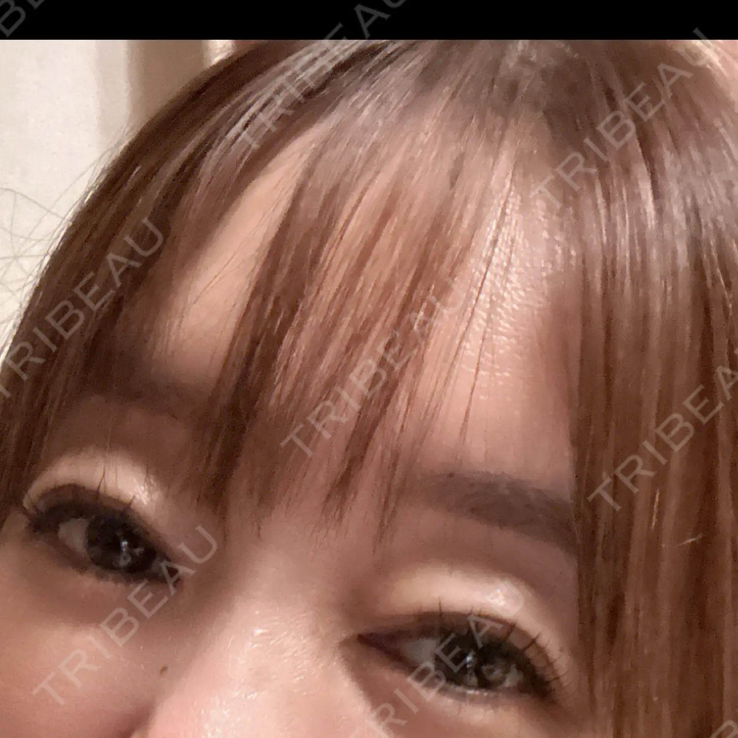 施術後の写真