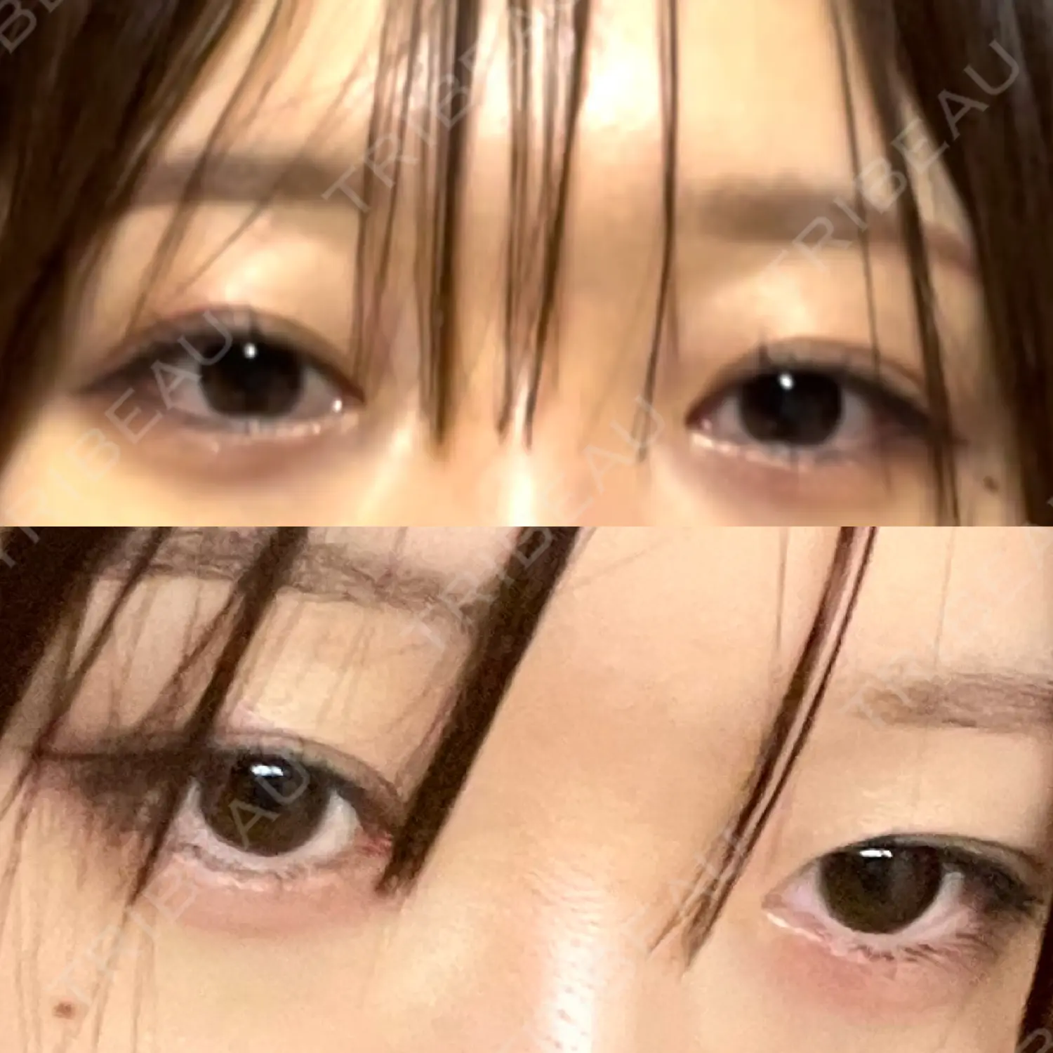 施術後の写真