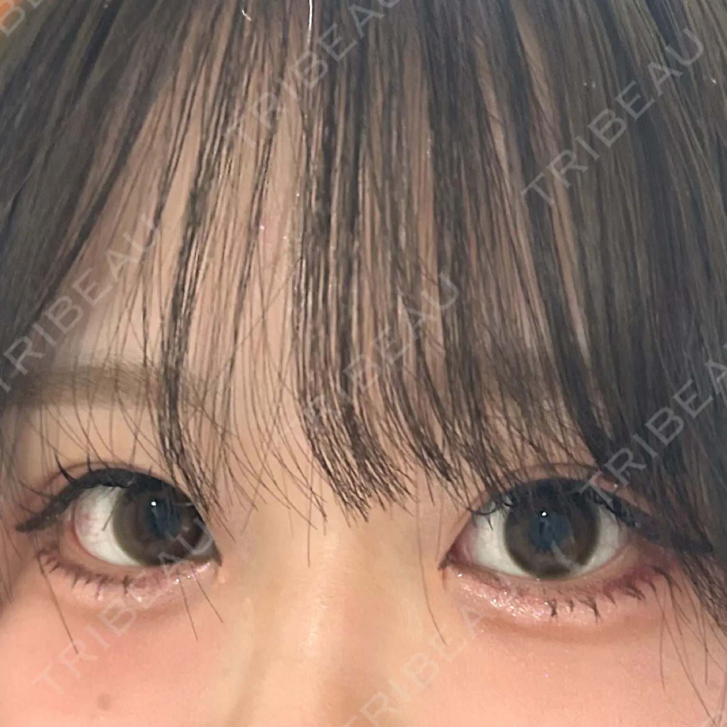 施術後の写真