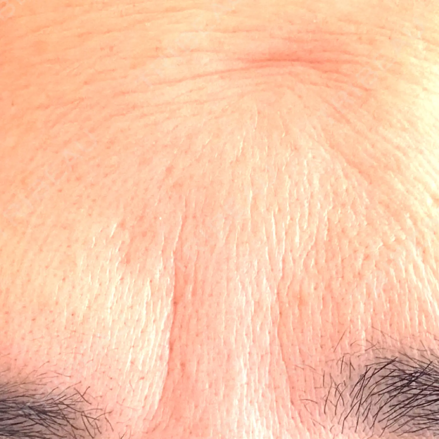 施術後の写真