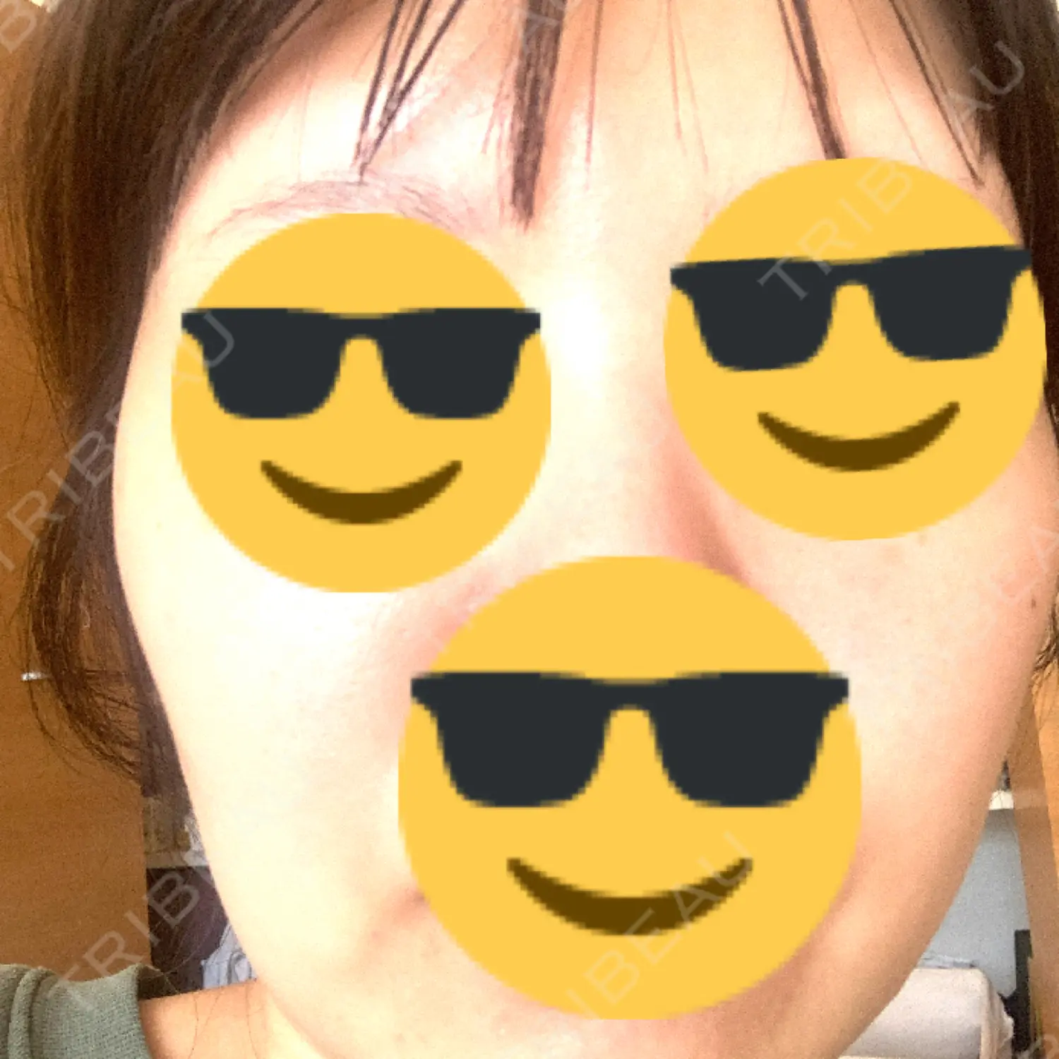 施術後の写真