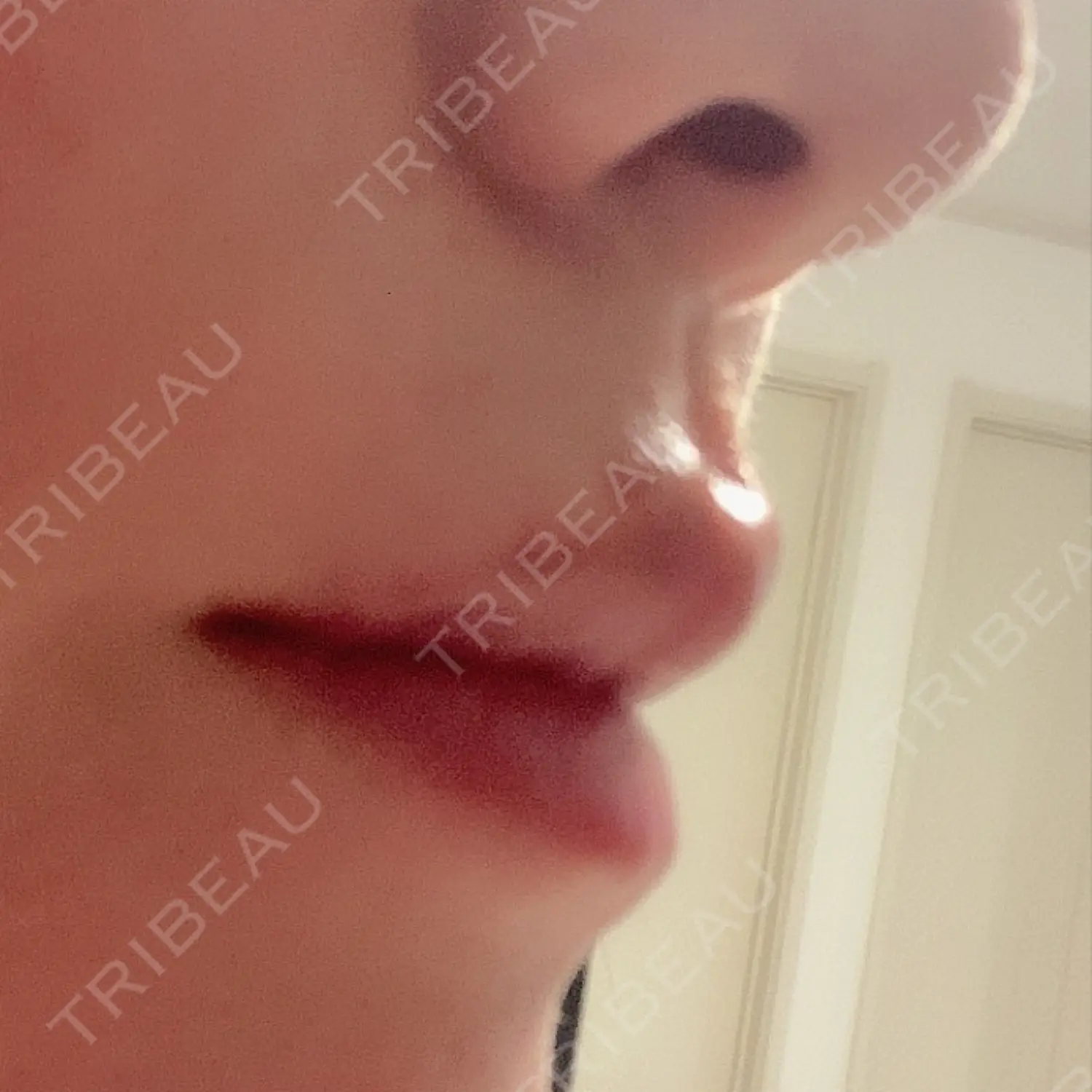 施術後の写真