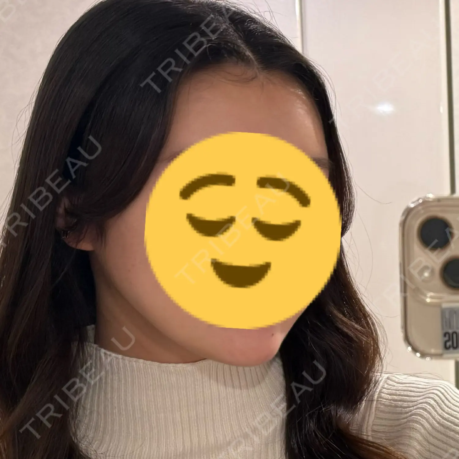 施術後の写真