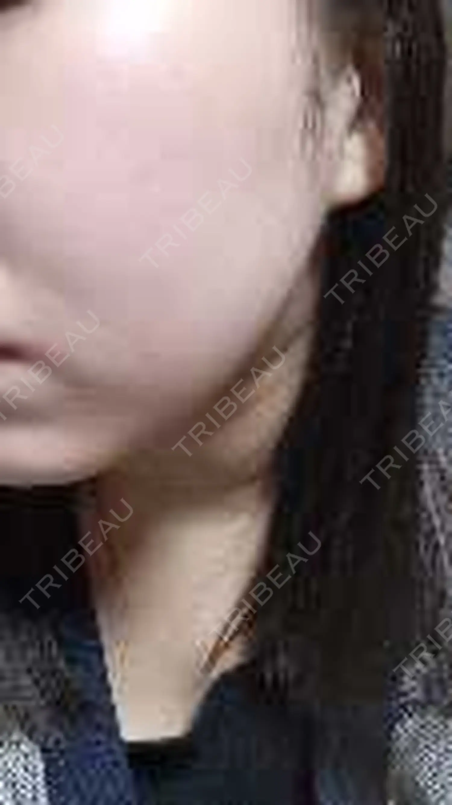 施術後の写真