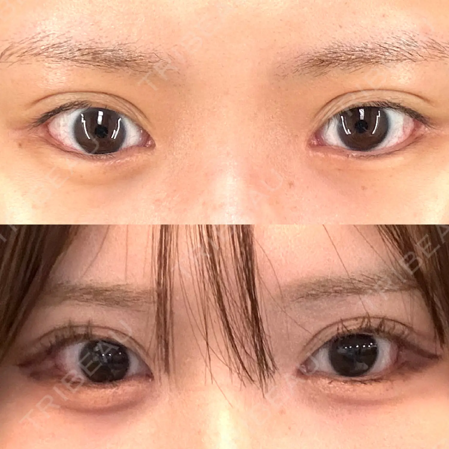 施術後の写真