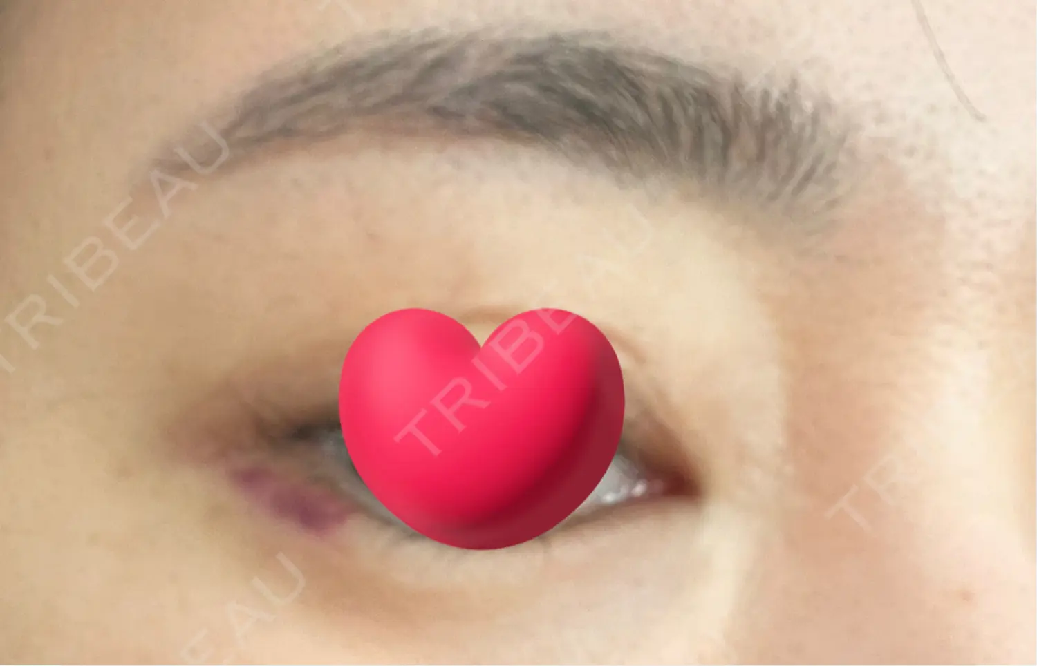 施術後の写真