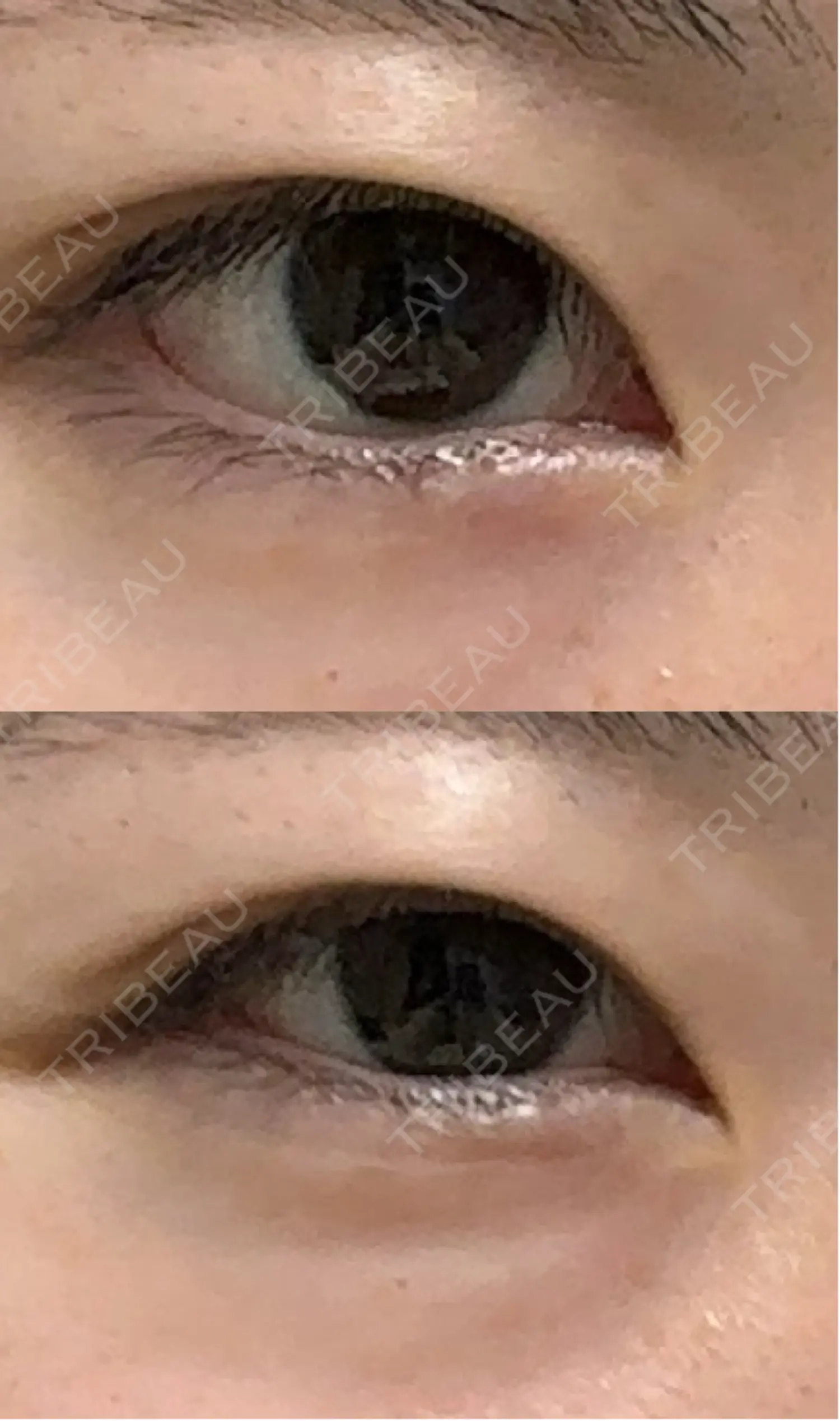 施術後の写真