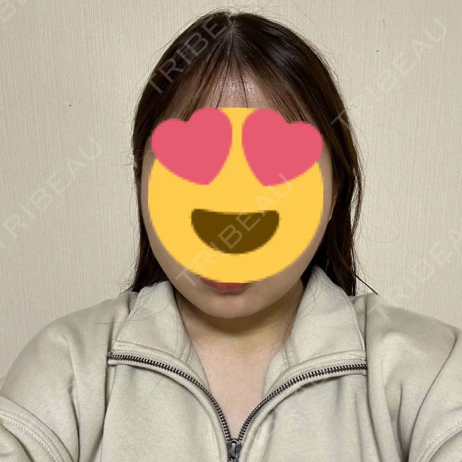 施術後の写真