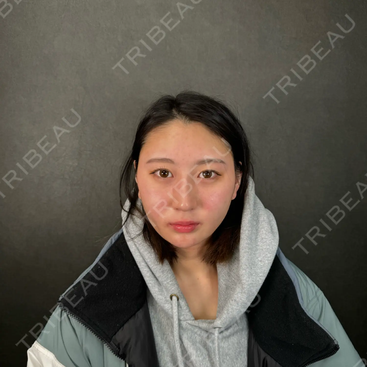 施術後の写真