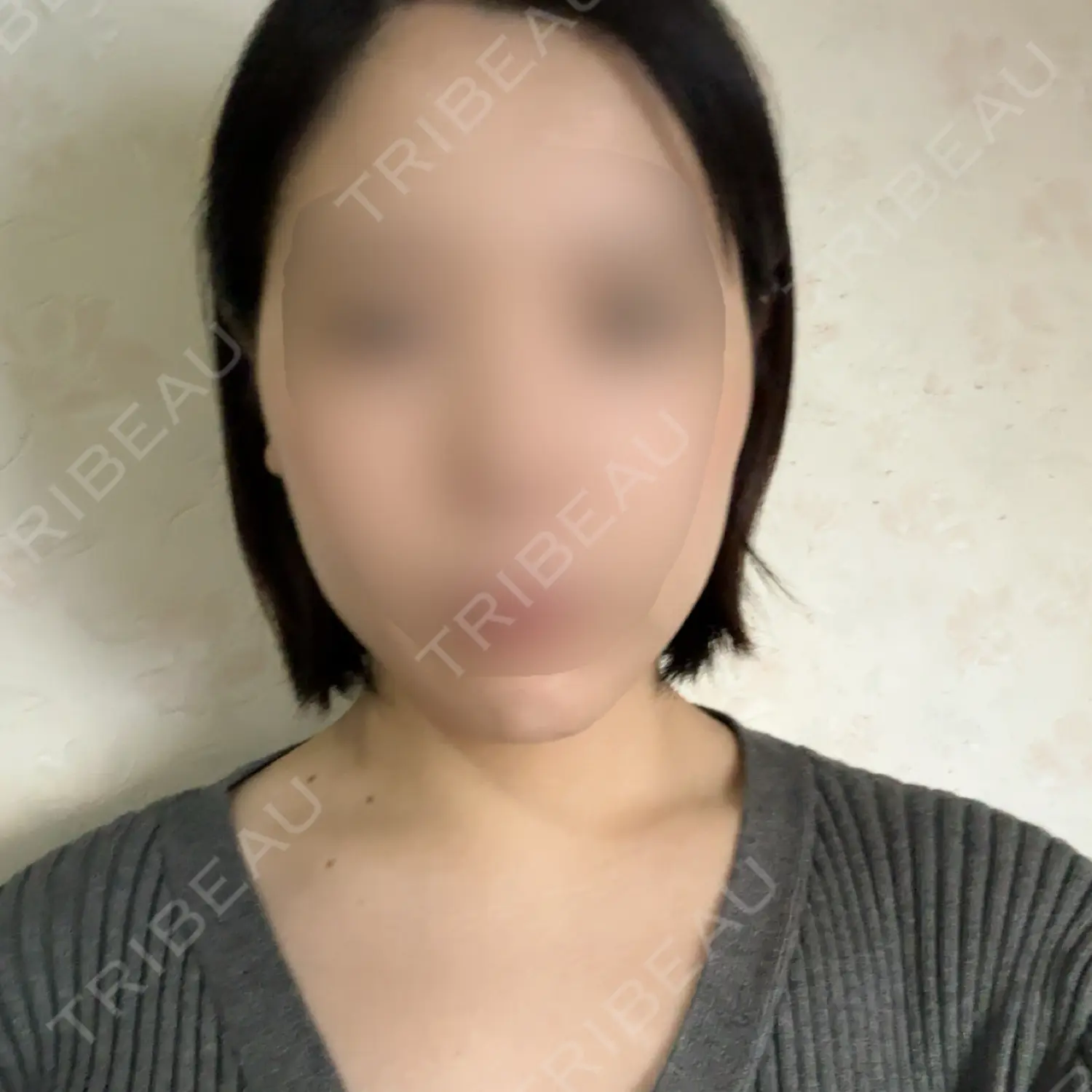 施術後の写真