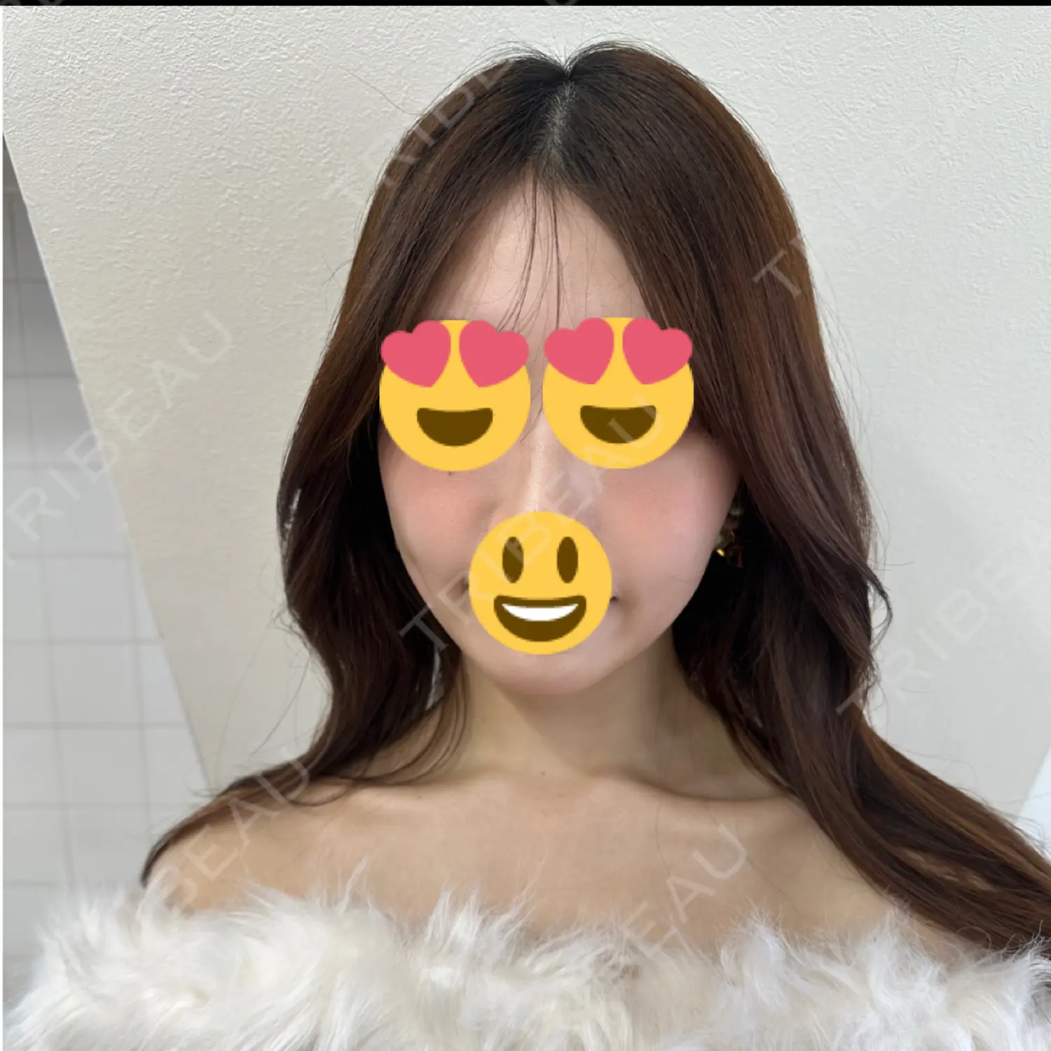 施術後の写真