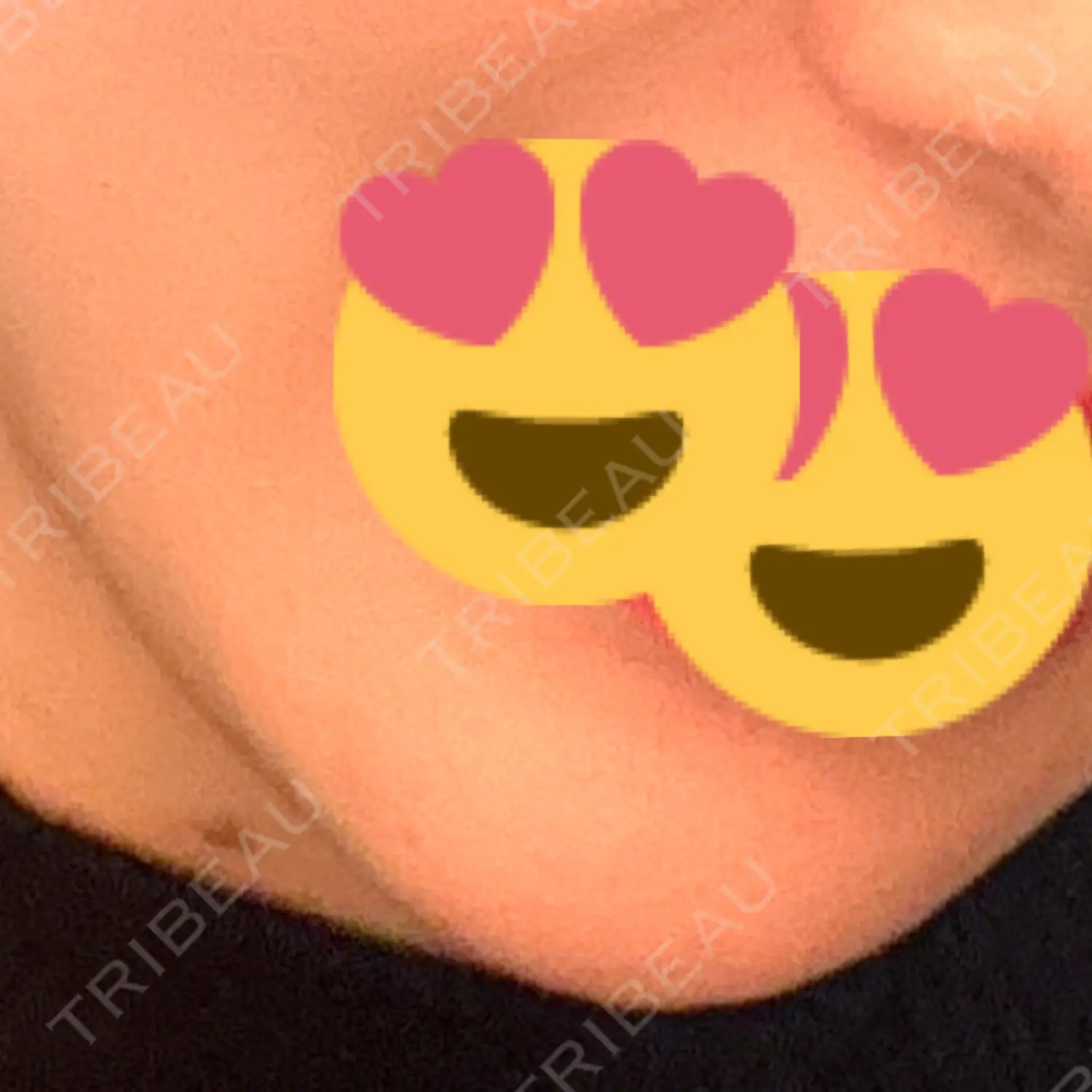 施術後の写真