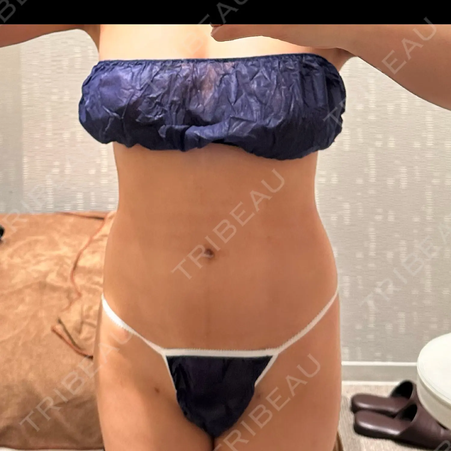 施術後の写真