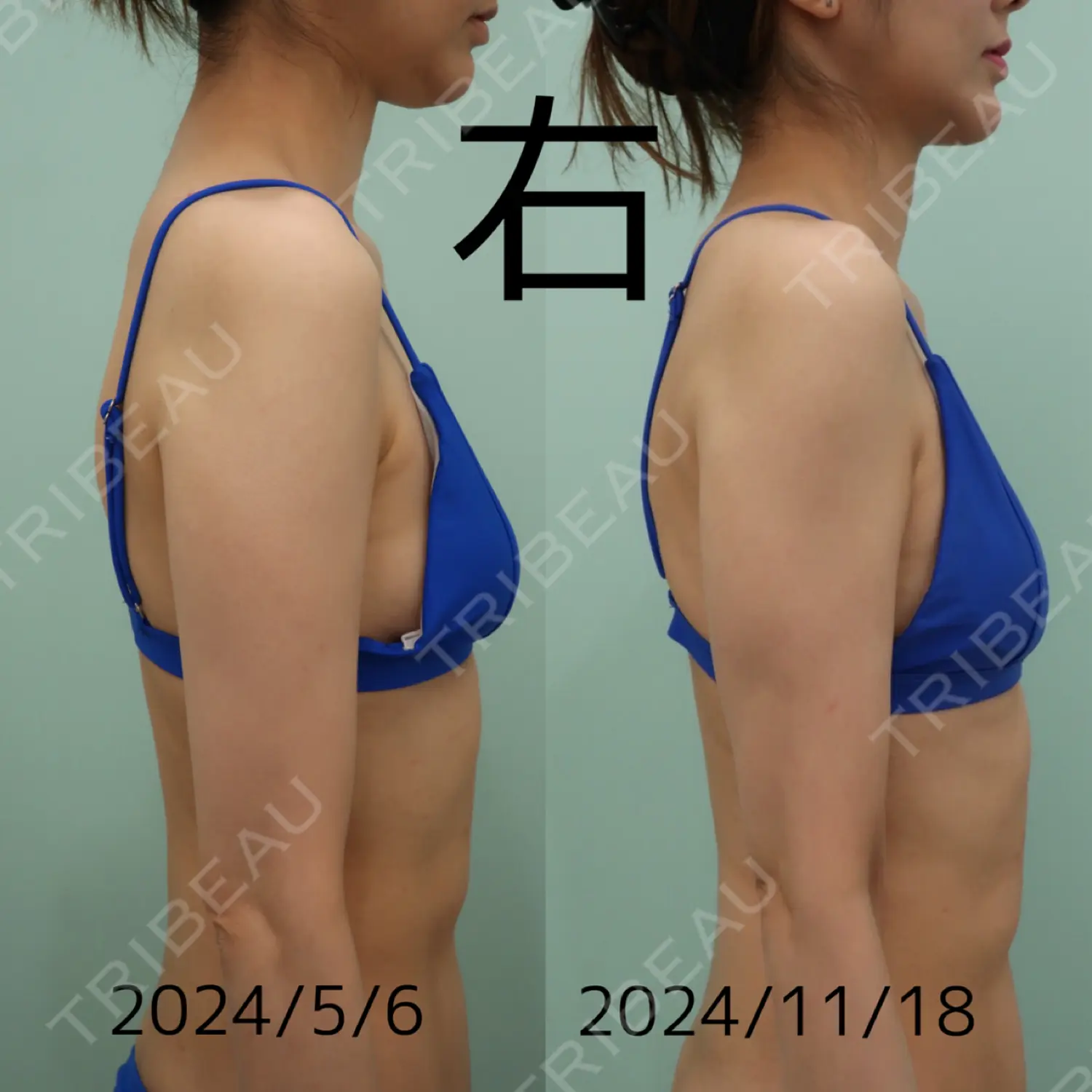 施術後の写真