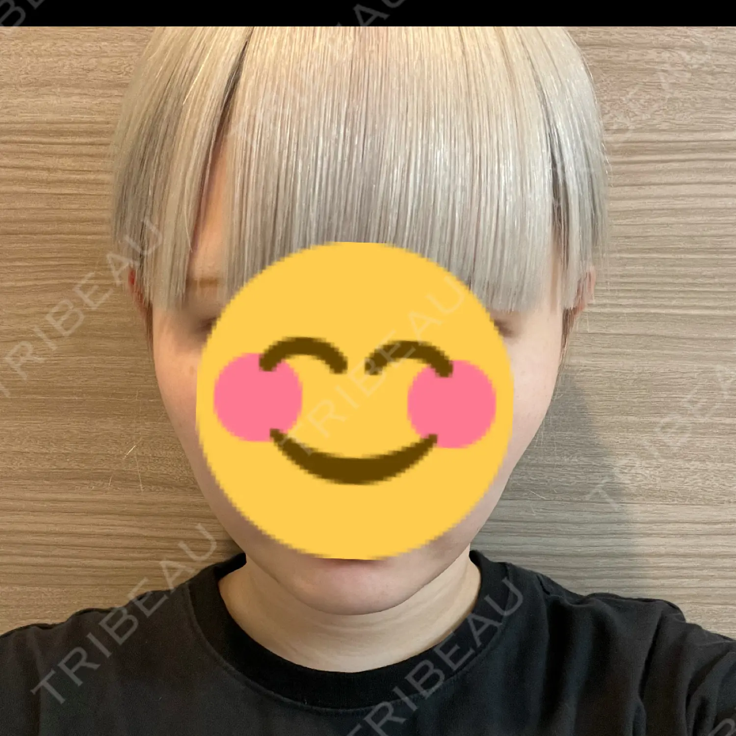 施術後の写真