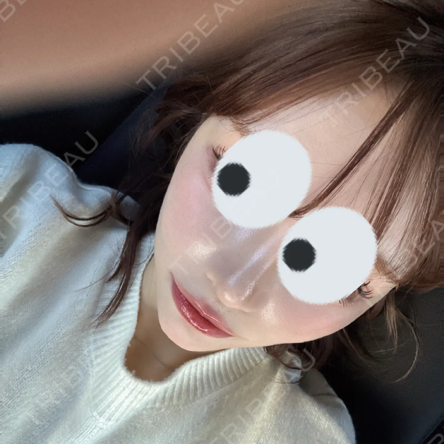 施術後の写真