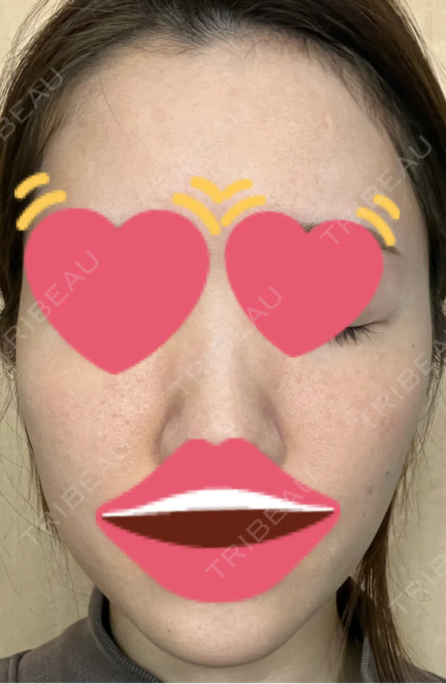 施術後の写真
