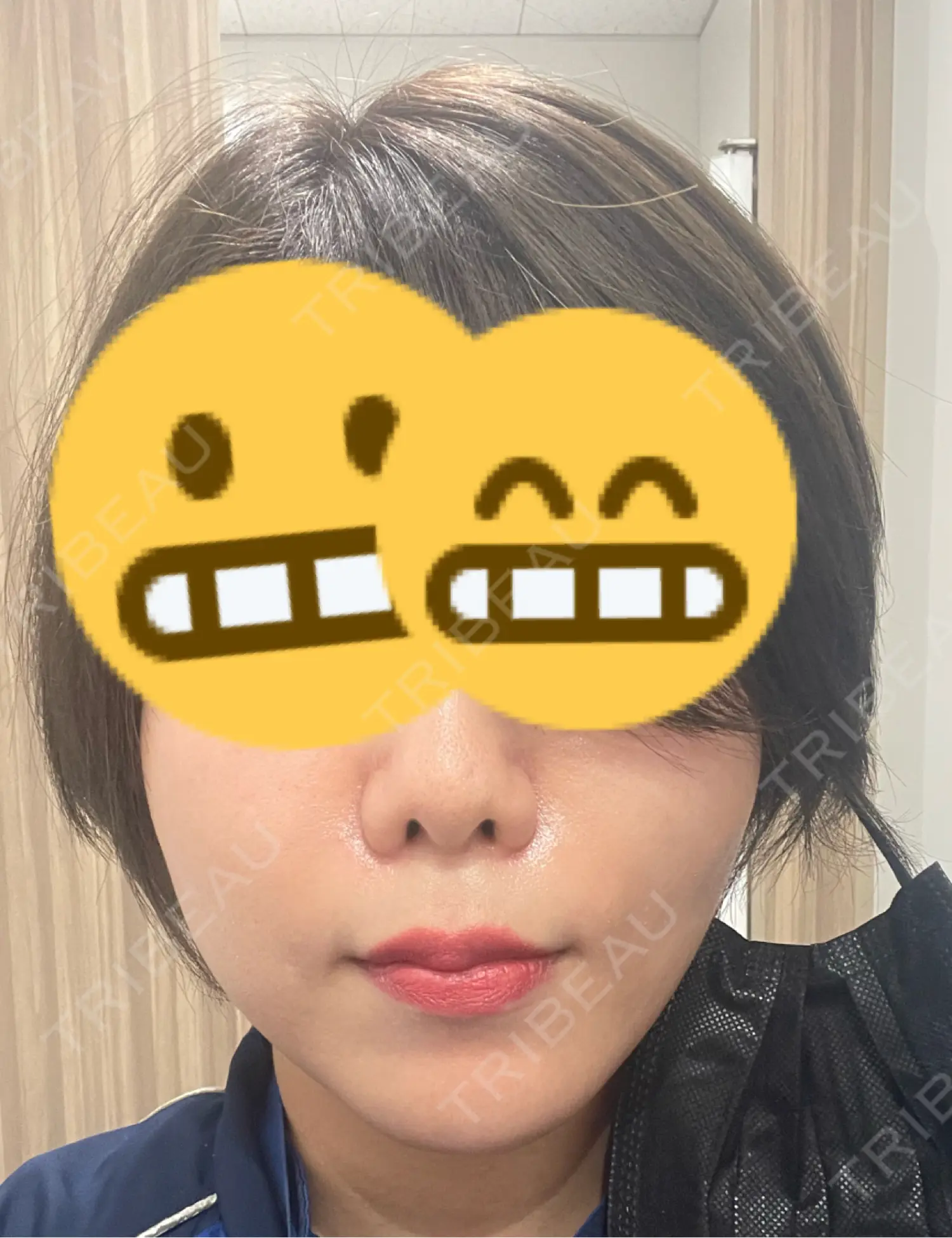 施術後の写真
