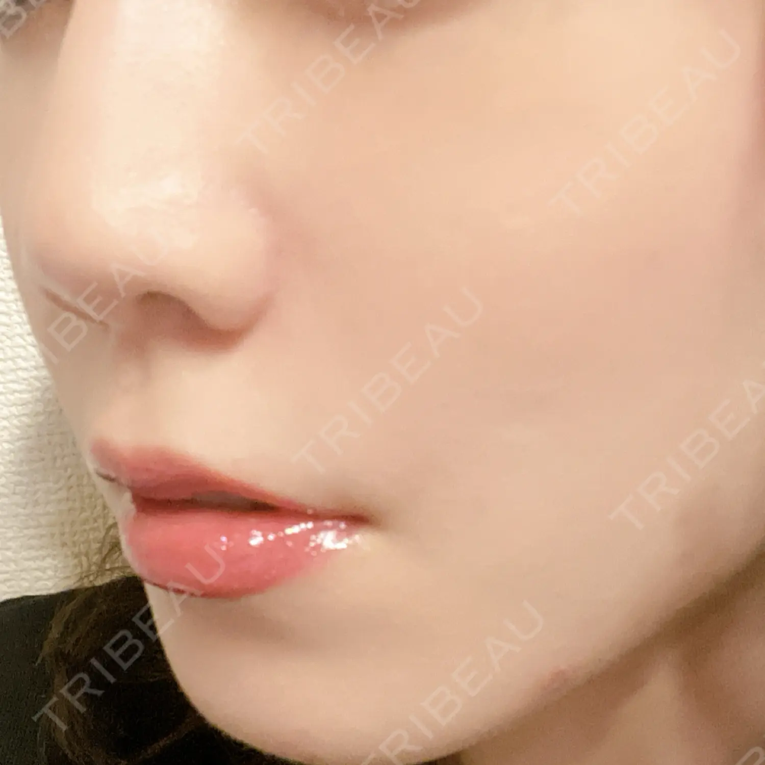 施術後の写真