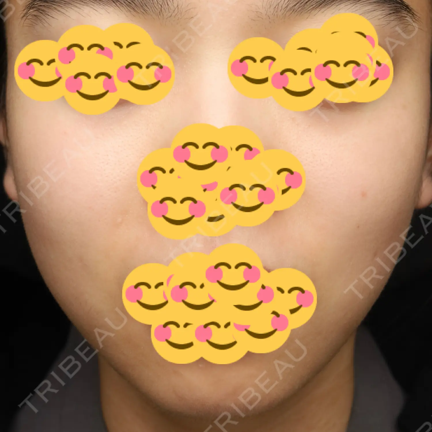 施術後の写真